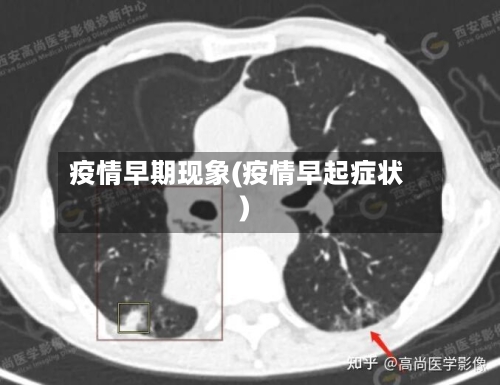 疫情早期现象(疫情早起症状)-第2张图片